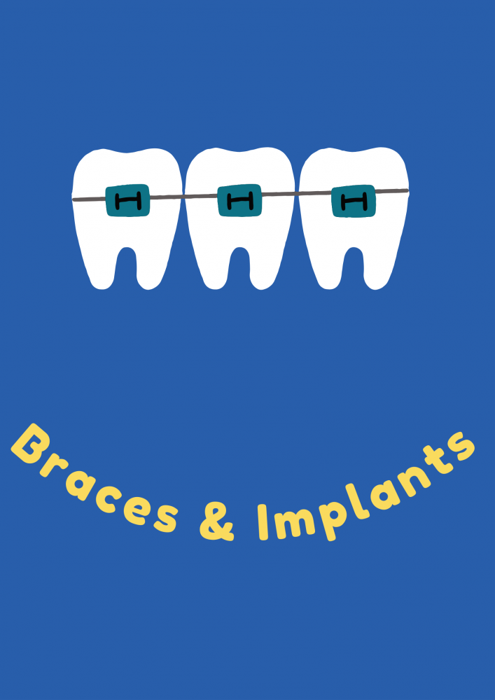 Braces & Implants