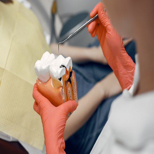 Root Canal Treatment (RCT)