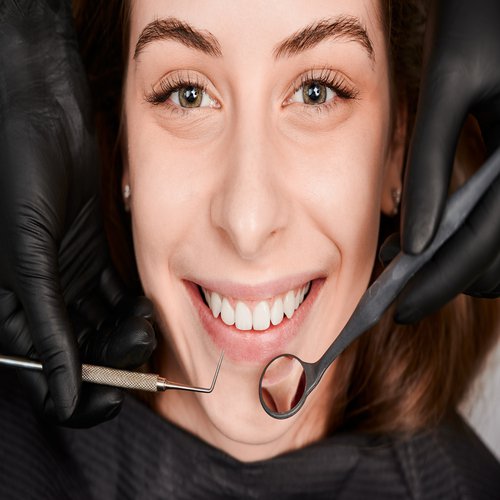 Teeth Polishing